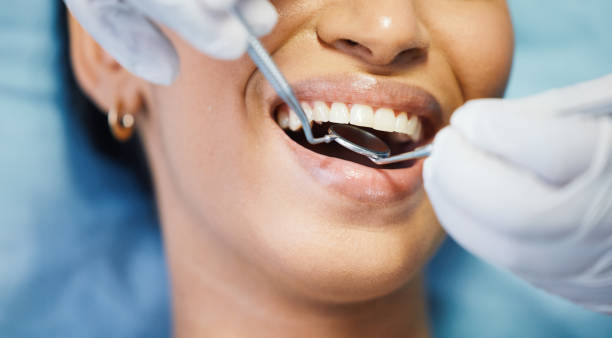 Best Emergency Tooth Extraction in Warren, IL